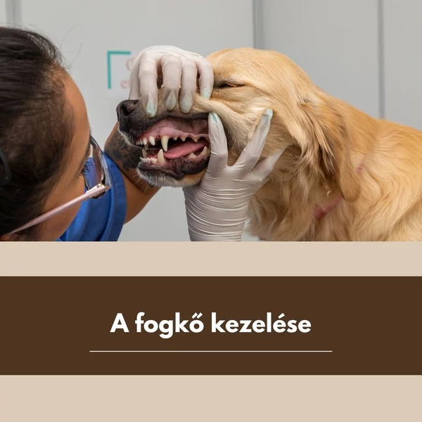 A fogkő kezelése